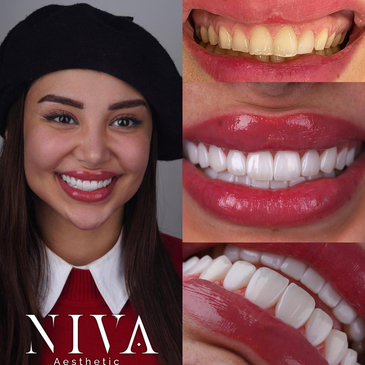 Slider image (3) Best Dental Clinic in Istanbul - Niva Aesthetic